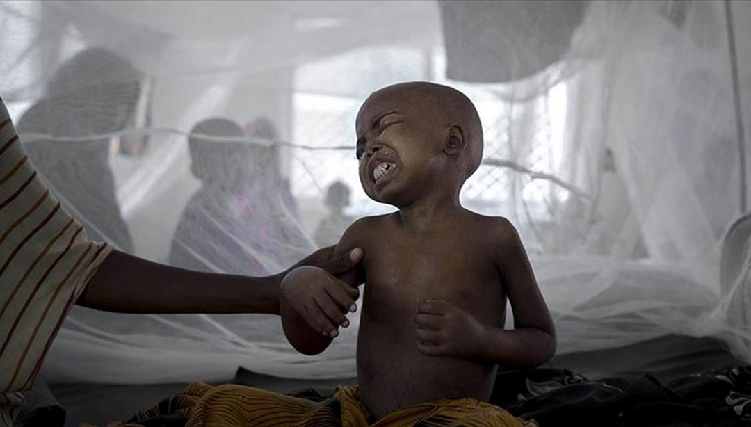 Sudan’da kolera salgını: Ölenlerin sayısı 334’e çıktı – Son Dakika Dünya Haberleri
