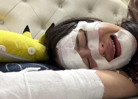 Doğum gününde facia: Elinde patlayan balon yüzünü yaktı! - Son Dakika Dünya Haberleri