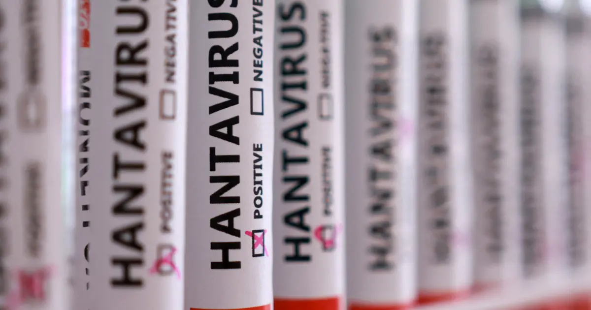 Hantavirüs paniği. Hollandalı kabin memurunun testi negatif çıktı